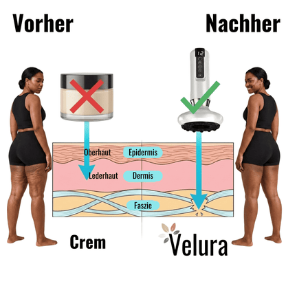 Velura™ | Drainage-Massagegerät für straffe und leichte Beine